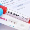 Không nên mua bộ test nhanh Covid-19 kháng nguyên chưa được cấp phép