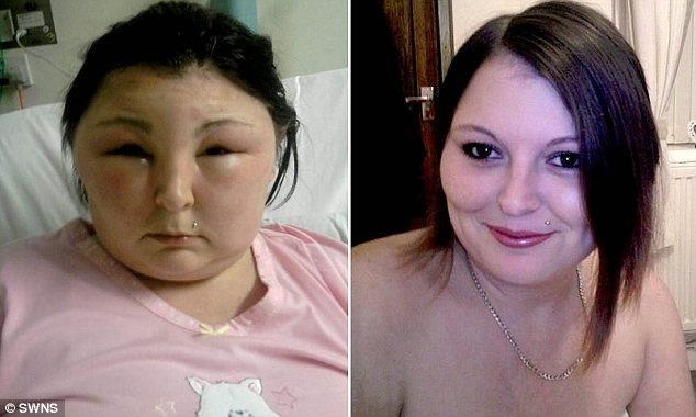 Tự nhuộm tóc khiến mắt bị mù và mặt bị biến dạng hoàn toàn ảnh 1