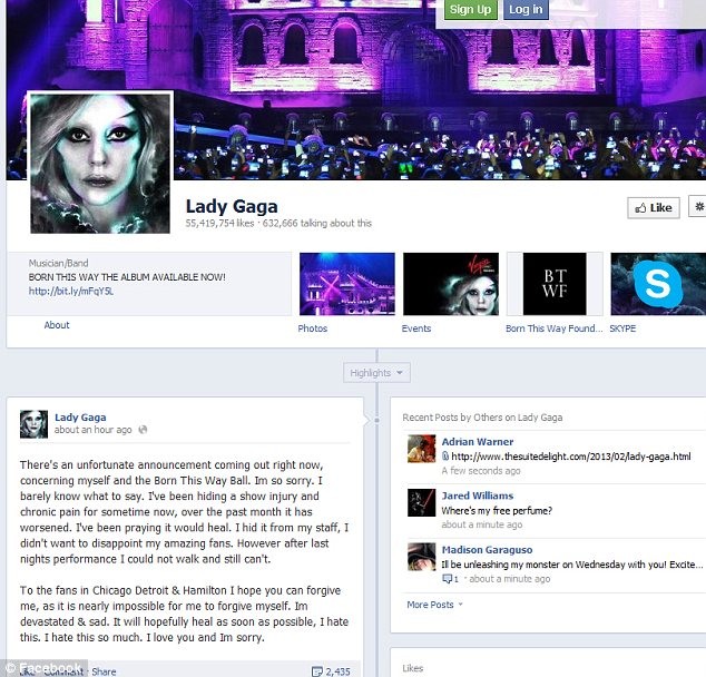 Lady Gaga “gặp hạn” đầu năm mới ảnh 1