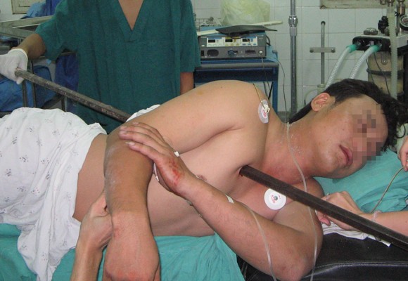 Rợn người với tai nạn lao động ảnh 1