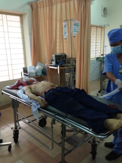 Bị khối sắt lớn rơi trúng đầu, nam công nhân tử vong ảnh 1
