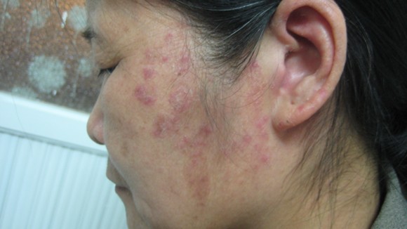 Kỳ 2: Khi người dân thích làm bác sỹ ảnh 1