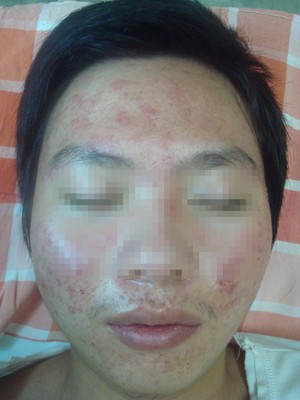 Kỳ 2: Khi người dân thích làm bác sỹ ảnh 2
