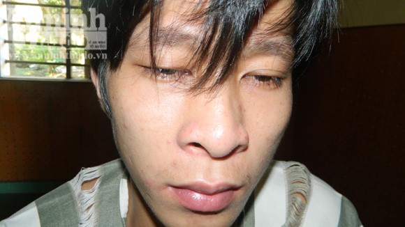 Khiếp hãi kẻ đập đầu người yêu, tưới xăng đốt ảnh 1