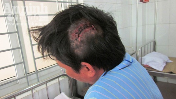 Côn đồ vô cớ vác kiếm chém người nhập viện ảnh 2