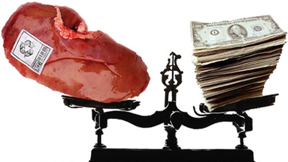 Ukraina: Truy tố kẻ chuyên buôn bán nội tạng người ảnh 1