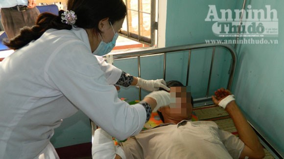 Truy bắt nhóm trộm, một người dân bị thương nặng ảnh 1