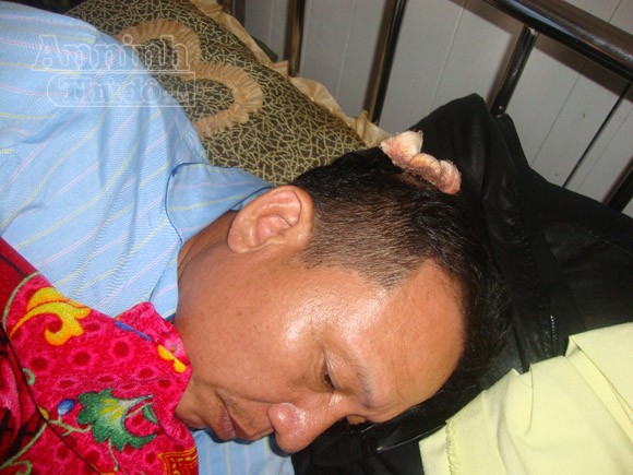 Vô cớ bị hàng xóm dùng ống tuýp đánh trọng thương ảnh 2