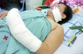 Chân dung bà lão 73 vác dao chém "tình địch" của chồng hờ ảnh 1