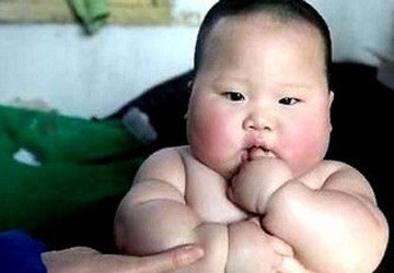 Phát hiện gen gây béo phì hay gặp ở trẻ em ảnh 1