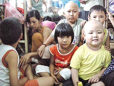 Dị tật bẩm sinh liên quan tới ung thư ở trẻ em ảnh 1