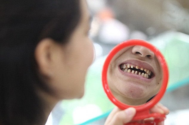 Mẹ thẩm mỹ răng hỏng, con khóc thét ảnh 1