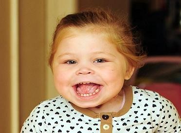 Hạnh phúc đến với em bé có cái lưỡi “khổng lồ” ảnh 2