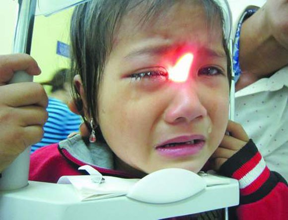 Nguy cơ mù mắt từ nhầm lẫn bệnh viêm cầu nhãn với đau mắt đỏ ảnh 1
