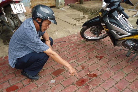 Một thanh niên bị đâm trúng tim, ngã gục trên vỉa hè ảnh 1