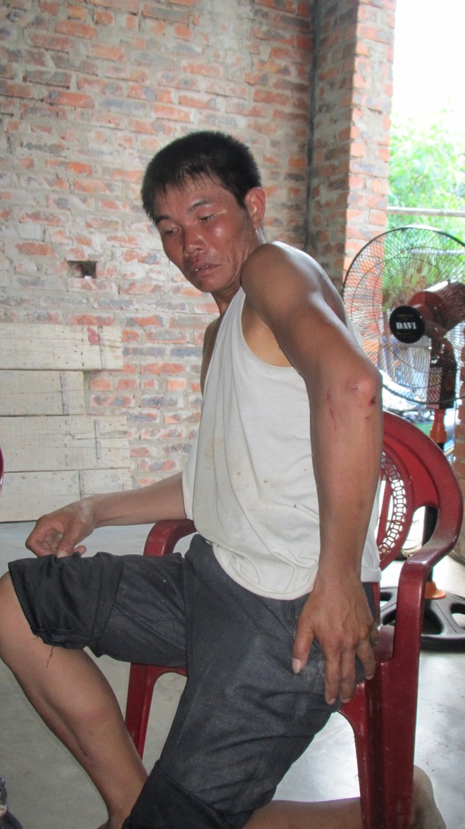 Người chống tham nhũng bị kẻ lạ mặt tấn công ảnh 1