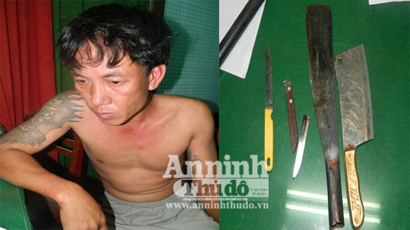 Bắt côn đồ chém người, một cảnh sát bị thương ảnh 1