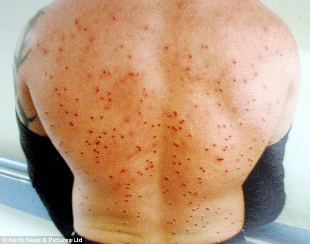 150 viên đạn găm vào người vẫn sống ảnh 2