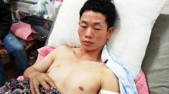 Nổ lò luyện thép: Hai người chết, nhiều người bị kim loại xuyên thấu ảnh 1