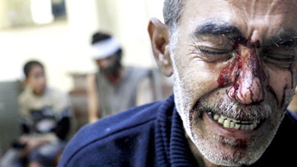 Syria - Chiến trường không thể kiểm soát ảnh 1