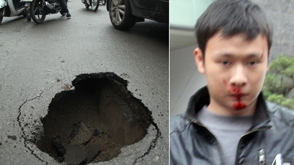 Một người phải nhập viện vì “hố tử thần” ảnh 1