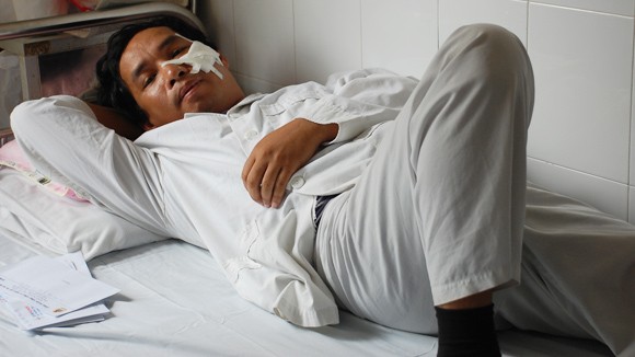 Đã câu trộm điện còn chém người ảnh 1
