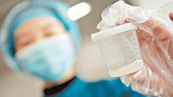 Bạn có biết về ngân hàng tinh trùng và thụ thai từ tinh trùng đông lạnh 15 năm? ảnh 1