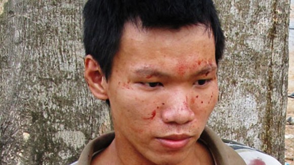 Bi kịch gia đình con đâm chết cha, người mẹ tâm thần không hề hay biết ảnh 1