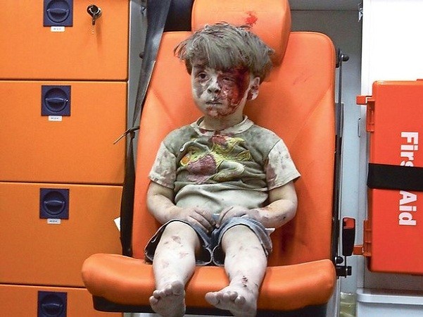 Anh trai "cậu bé Syria" đã qua đời do trúng không kích ảnh 2
