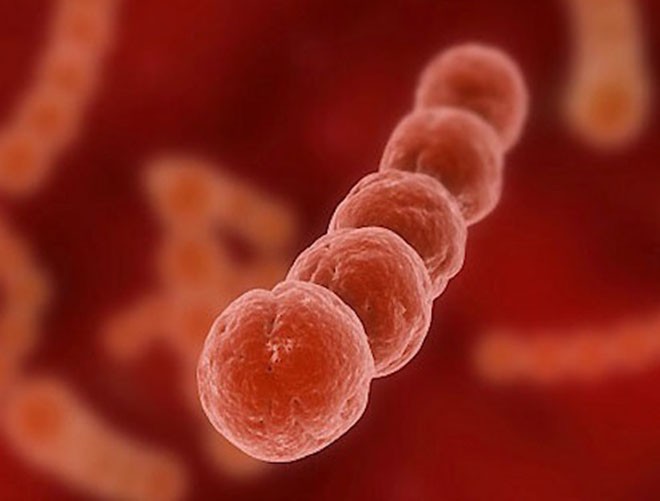 Những hình ảnh đáng sợ về bệnh nhiễm liên cầu khuẩn lợn ảnh 8