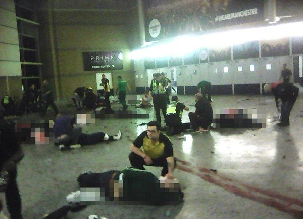 Hai người hùng vô gia cư cứu giúp nạn nhân vụ đánh bom Manchester ảnh 3