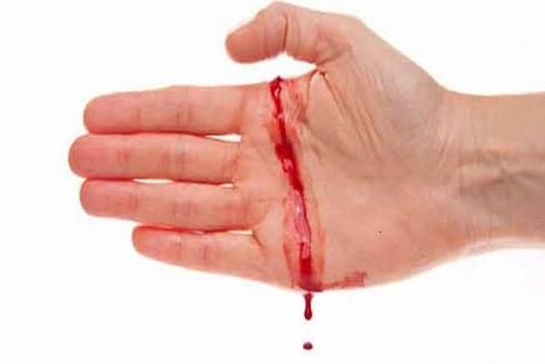 Những tuyệt chiêu cầm máu khi bị đứt tay cần phải lưu tâm ảnh 1