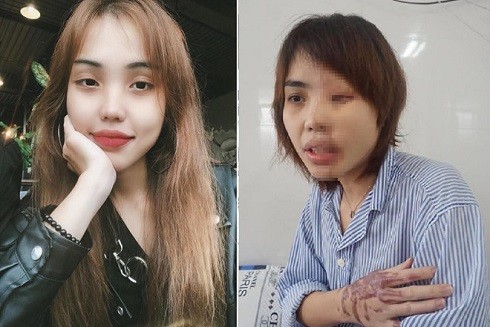 Nguyên nhân và hậu quả của axit tàn phá cơ thể gây nguy hiểm nghiêm trọng ảnh 1