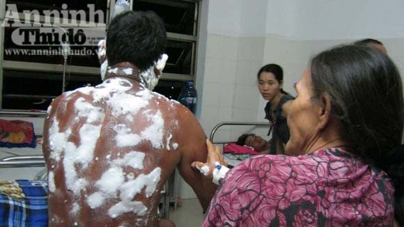 Đứa cháu bất nhân tạt hóa chất rồi đốt vợ chồng bác ruột ảnh 1
