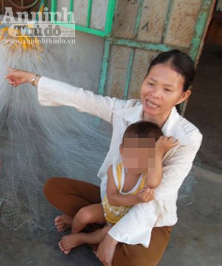 Vừa hận, vừa thương kẻ nhiều lần rạch mặt bé 20 tháng tuổi ảnh 3