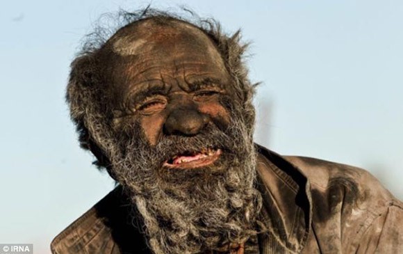 Người đàn ông bẩn nhất thế giới - 60 năm không tắm ảnh 1