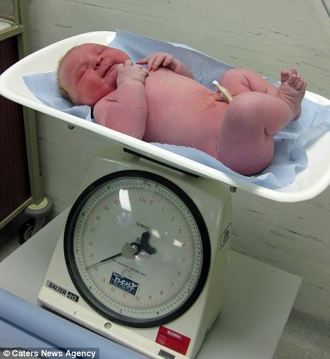Bé sơ sinh nặng tới 6,5 kg ảnh 1