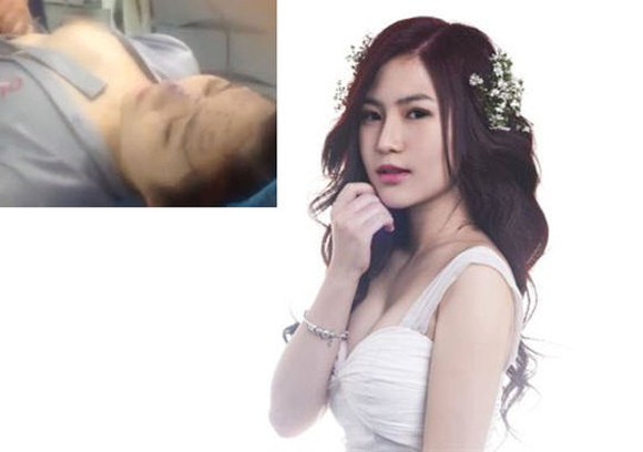 Ca sĩ Hương Tràm nâng mũi vì nhân tướng học! ảnh 3