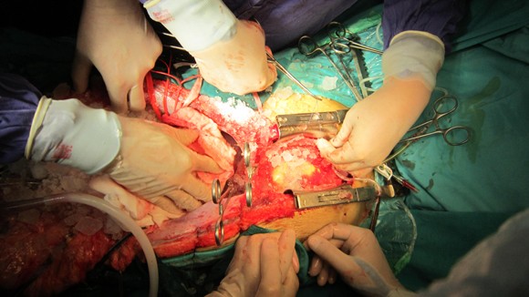 Quyết định hiến tạng sau khi chết não: Một người cứu sống 4 người ảnh 1
