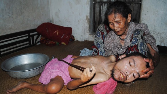 Câu chuyện một người mẹ “khất thực” nuôi con đầy cảm động ảnh 1