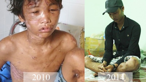 Về vụ Hào Anh ngược đãi cha mẹ: Bài học đau xót về tình thương ảnh 1
