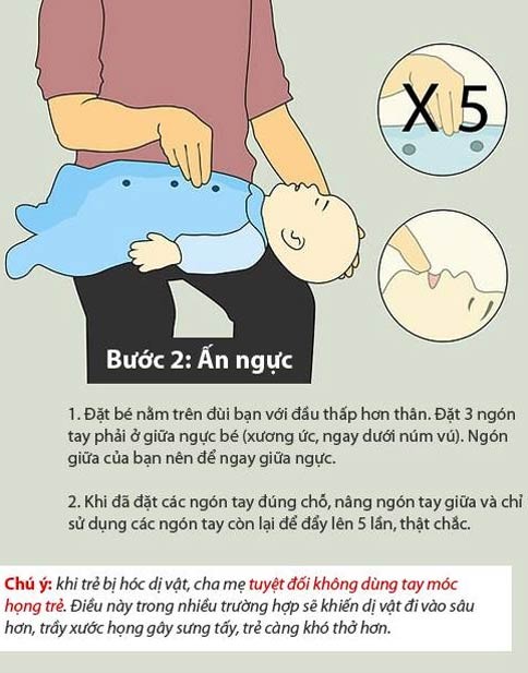 Báo động tình trạng hóc dị vật ở trẻ em ảnh 4